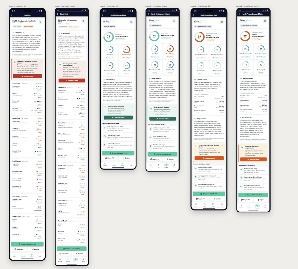 Alocare consumer screens showing lab results, stress resilience, and eye exam insights